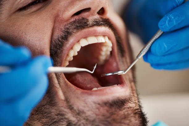 Best Mobile Emergency Dentist in Inesville, GA