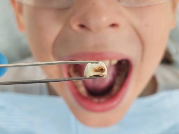 Best 24-Hour Emergency Dentist in Inesville, GA